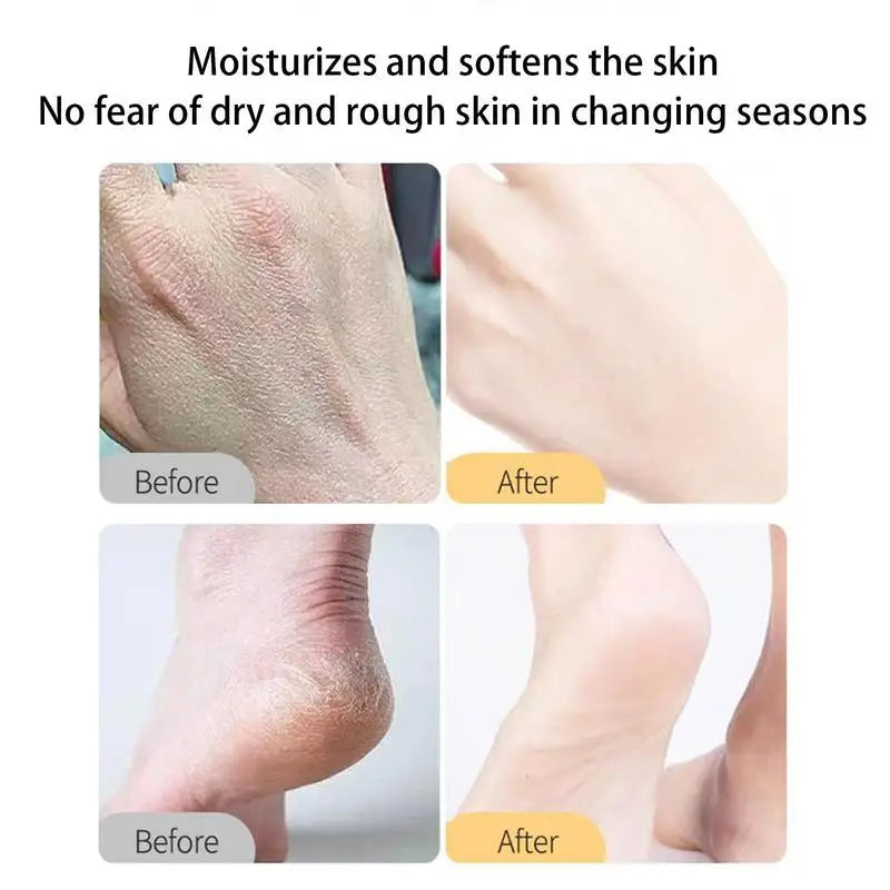 Fruity Scent Anti-Dry Cracked Remove Heel Dry Dead Deep Nourishing Body Moisturizing Balm Stick With Natural Plant Extracts
